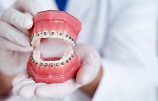 Gloved hands holding model with traditional braces