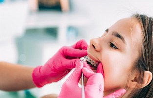 Orthodontist with pink gloves placing braces on child