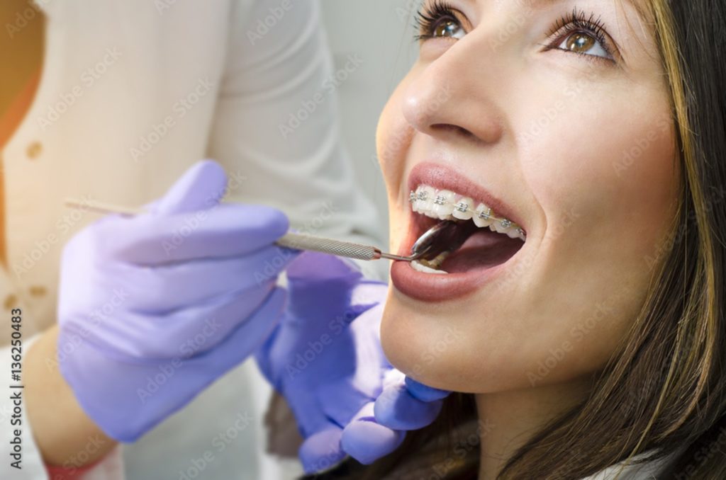 Patient with braces at the orthodontist for a checkup.  