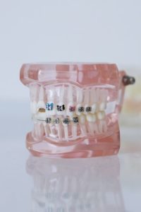 Dental model used for metal braces