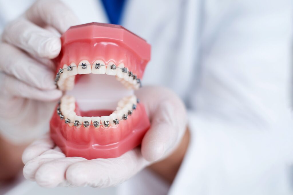 Dentist in white gloves holding model teeth with braces
